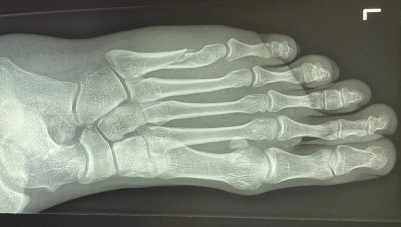 De la casse pour Constant Van Paesschen