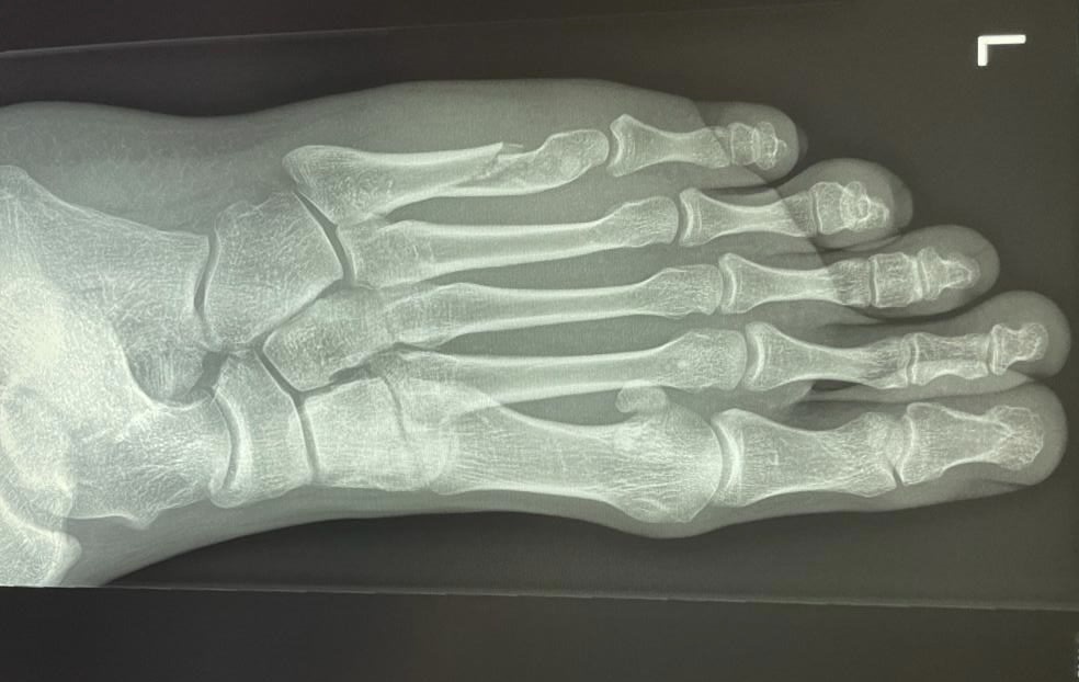 De la casse pour Constant Van Paesschen